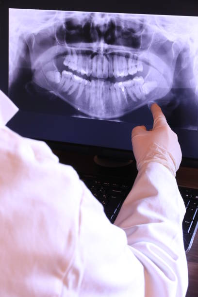 Best Emergency Dentist for Lost Fillings or Crowns in Clay City, IN
