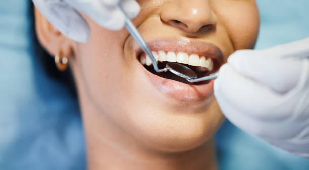 Best Broken or Cracked Tooth Emergency Dentist in Clay City, IN