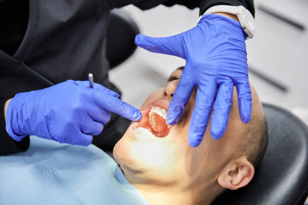 Best Emergency Dentist for Knocked-Out Tooth in Clay City, IN